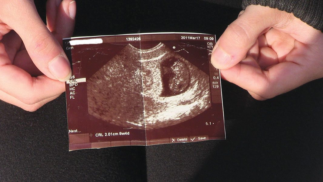 Hands holding a sonogram photo