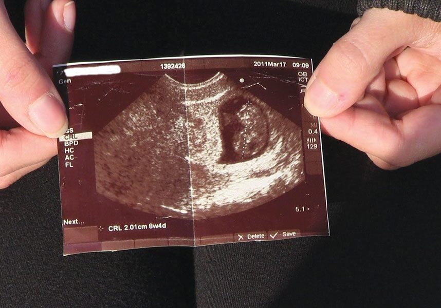 Hands holding a sonogram photo